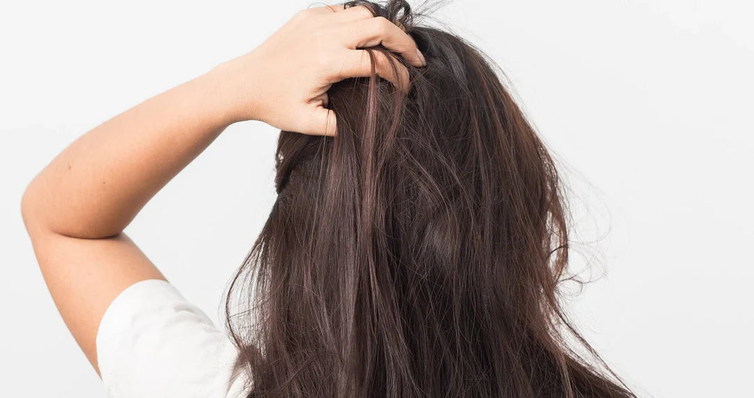 Get Rid of Dandruff