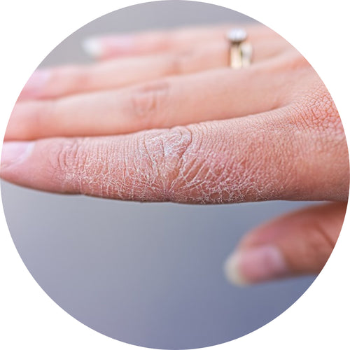 Best Skincare Oil for Dry Skin