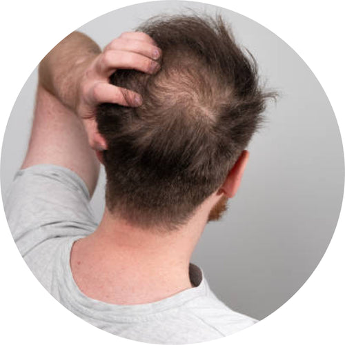 Natural Hair Oil for Hair Fall and Thinning